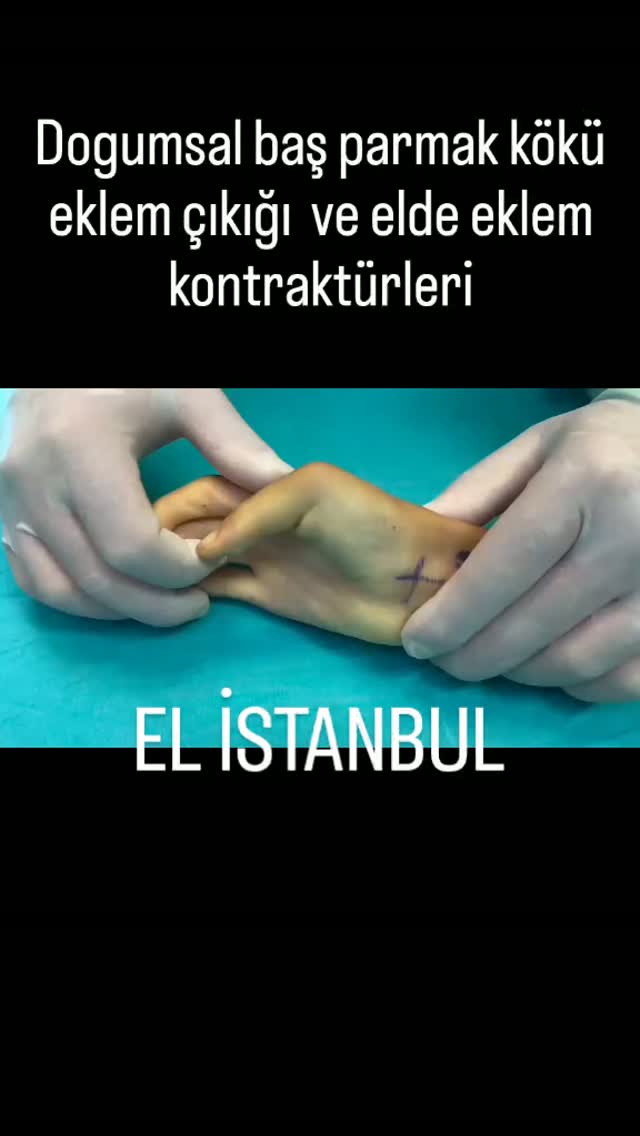 elcerrahi