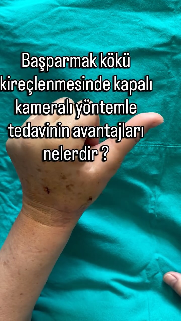 elcerrahi