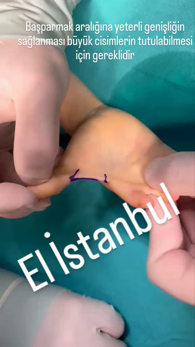 elcerrahi